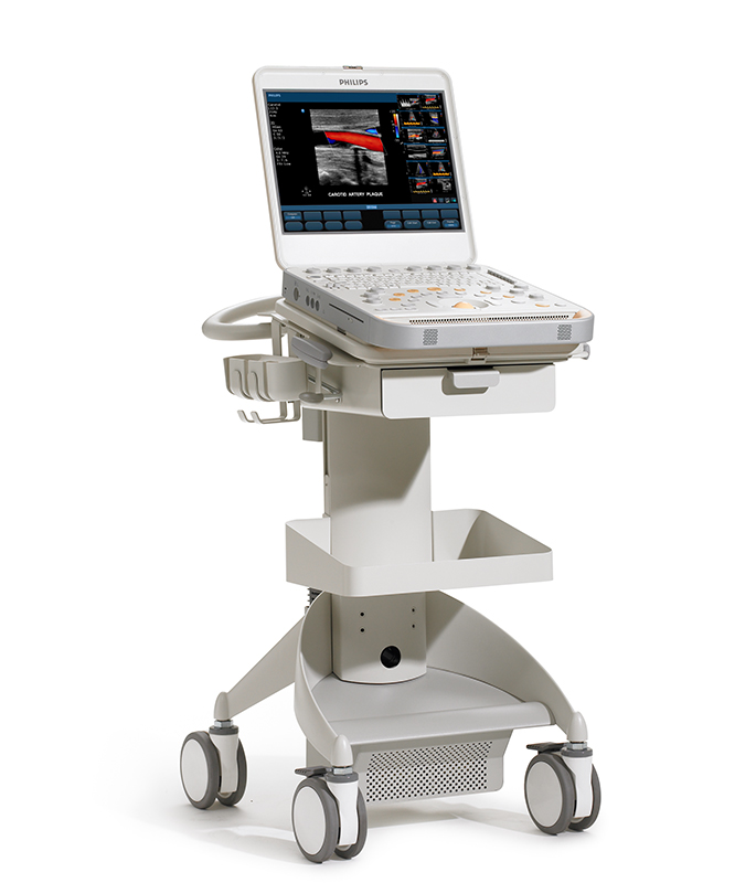 Máy siêu âm xách tay CX50 xMATRIX Philips